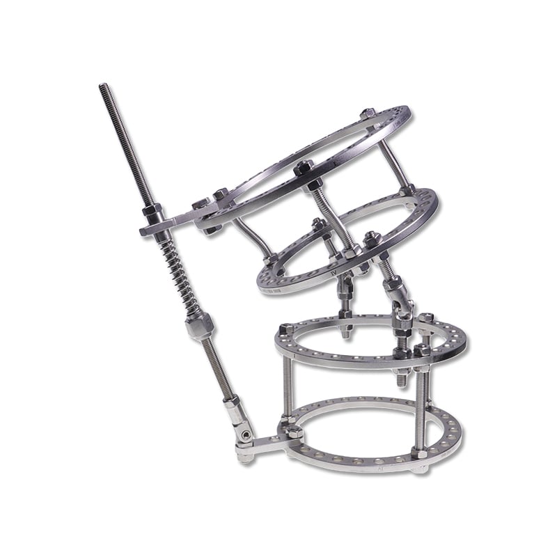 Knee Joint Configuration of Ring External Fixator